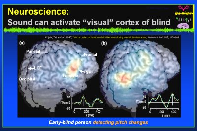 Kujala et al. (1995) Visual cortex activation in blind humans during sound discrimination, Neurosci. Lett. 183, 143146